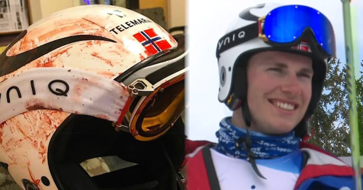 Campeón de telemark demuestra por qué es importante utilizar un casco